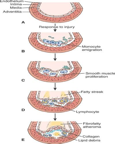 pathophysiology hesi quizlet